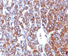Formalin-fixed, paraffin-embedded human melanoma stained with Moesin antibody (MSN/492)