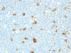 Formalin-fixed, paraffin-embedded human tonsil stained with Calgranulin A + B antibody (CAGB/426)