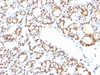 Formalin-fixed, paraffin-embedded human thyroid stained with TTF1 antibody (NX2.1/690)