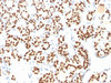 SDS-PAGE Analysis of Purified, BSA-Free TLR2 Antibody (clone TLR2/221) . Confirmation of Integrity and Purity of the Antibody.