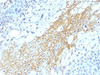 Formalin-fixed, paraffin-embedded human tongue stained with CD59 antibody (MACIF/1193)