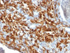 Formalin-fixed, paraffin-embedded human lymphoma stained with CD79a antibody (IGA/515) .