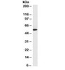 Western blot testing of A431 cell lysate and Cytokeratin 10 + 13 antibody (clone SPM262) .