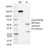 SDS-PAGE Analysis of Purified, BSA-Free SCLC Marker Antibody (clone MOC-52) . Confirmation of Integrity and Purity of the Antibody.