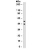 Western blot testing of HeLa cell lysate with Cytokeratin 8 + 18 antibody (clone SPM141) .