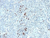Formalin-fixed, paraffin-embedded human tonsil stained with Kappa Light Chain antibody (TB28-2) .