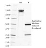 SDS-PAGE Analysis of Purified, BSA-Free IgG Antibody (clone IG217) . Confirmation of Integrity and Purity of the Antibody.