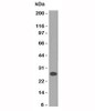 Western blot of human Intestinal lysate using Lambda Light Chain antibody (HP6054) .