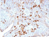 Formalin-fixed, paraffin-embedded human tonsil stained with Lambda antibody (LAM03) .