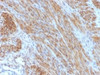 IHC testing of FFPE human uterus with Desmin antibody (clone DES/1711) . Required HIER: boil tissue sections in 10mM citrate buffer, pH 6, for 10-20 min.