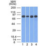 Western blot testing of human 1) HT20, 2) A549, 3) HEK293 and 4) A431 cell lysate with Plakoglobin antibody (clone 11E4) . Predicted molecular weight: 80-87 kDa.