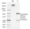 SDS-PAGE Analysis of Purified, BSA-Free ACTH Antibody (clone CLIP/1418) . Confirmation of Integrity and Purity of the Antibody.