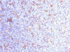IHC testing of FFPE human tonsil with CD11c antibody (clone ITGAX/1284) . Required HIER: boil tissue sections in 10mM Tris with 1mM EDTA, pH 9.0, for 10-20 min.
