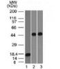 Western blot testing of 1) a partial recombinant protein, 2) human Jurkat and 3) human A549 lysate with Alpha 1 Antitrypsin antibody (clone AAT/1378) . Expected molecular weight: ~47 kDa (unmodified) , 52 kDa (glycosylated) .