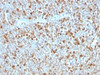 IHC testing of FFPE human tonsil with Alpha 1 Antitrypsin antibody (clone AAT/1379) . Required HIER: steam sections in pH6, 10mM citrate buffer for 10-20 min.