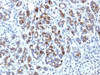 IHC testing of FFPE human pancreas with Alpha-1-Antichymotrypsin antibody (clone AACT/1451) . Required HIER: steam sections in pH6, 10mM citrate buffer for 10-20 min.