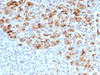 IHC testing of FFPE human pancreas with Alpha-1-Antichymotrypsin antibody (clone AACT/1452) . Required HIER: steam sections in pH6, 10mM citrate buffer for 10-20 min.