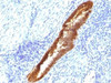 IHC testing of FFPE human endometrium with ASRGL1 antibody (clone CRASH/1289) . Required HIER: steam sections in 10mM Tris with 1mM EDTA, pH9, for 10-20 min.