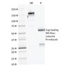 SDS-PAGE Analysis of Purified, BSA-Free AMACR Antibody (clone AMACR/1723) . Confirmation of Integrity and Purity of the Antibody.