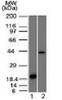 Western blot testing of 1) a partial recombinant protein and 2) human liver lysate with Aurora B antibody (clone AURKB/1521) . Predicted molecular weight: 39-45 kDa