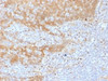 IHC testing of FFPE human tonsil tissue with Beta Catenin antibody (clone CTNNB1/1508) . Required HIER: boil tissue sections in 10mM Tris with 1mM EDTA, pH 9.0, for 10-20 min.