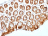 IHC testing of FFPE mouse colon tissue with b-Catenin antibody (clone CTNNB1/1509) . Required HIER: boil tissue sections in 10mM Tris with 1mM EDTA, pH 9.0, for 10-20 min.