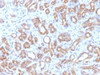 IHC testing of FFPE human pancreas tissue with b-Catenin antibody (clone CTNNB1/1509) . Required HIER: boil tissue sections in 10mM Tris with 1mM EDTA, pH 9.0, for 10-20 min.