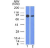 Western blot testing of human 1) A431 and 2) A549 cell lysate with Beta Catenin antibody (clone 5H10) . Expected molecular weight ~92 kDa.