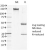 SDS-PAGE Analysis of Purified, BSA-Free DSG1 Antibody (clone 27B2) . Confirmation of Integrity and Purity of the Antibody.