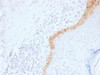 IHC testing of FFPE human skin with Keratin 15 antibody (clone LHK15) . Required HIER: boil tissue sections in 10mM citrate buffer, pH 6, for 10-20 min.