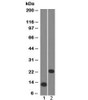 Western blot testing of 1) a partial recombinant protein and 2) human Jurkat cell lysate with CD3e antibody (clone C3e/1308) . Predicted molecular weight ~23 kDa.