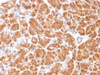 IHC testing of FFPE human pancreas with Clathrin Light Chain antibody (clone CLC/1421) . Required HIER: boil tissue sections in 10mM Citrate buffer, pH 6.0, for 10-20 min.