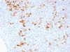 IHC testing of FFPE human tonsil stained with Kappa Light Chain antibody (clone KLC1278) . Required HIER: boil tissue sections in 10mM Tris with 1mM EDTA, pH 8, for 10-20 min.