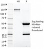 SDS-PAGE Analysis of Purified, BSA-Free Kappa Light Chain Antibody (clone KLC1278) . Confirmation of Integrity and Purity of the Antibody.