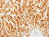 IHC testing of FFPE human liver with Connexin 32 antibody (clone GJB1/1753) . Required HIER: boil tissue sections in 10mM citrate buffer, pH 6, for 10-20 min.