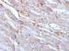 IHC testing of FFPE mouse heart with Cadherin 2 antibody (clone CDH2/1573) . Required HIER: boil tissue sections in 10mM Tis with1mM EDTA, pH 9, for 10-20 min.