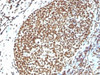 IHC testing of FFPE human tonsil and Histone H1 antibody. Required HIER: boil tissue sections in 10mM citrate buffer, pH 6, for 10-20 min.