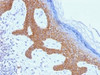 IHC testing of FFPE human skin with Desmoglein 3 antibody (clone DSG3/1535) . Required HIER: boil tissue sections in 10mM citrate buffer, pH 6, for 10-20 min.
