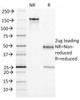 SDS-PAGE Analysis of Purified, BSA-Free Endoglin Antibody (clone ENG/1327) . Confirmation of Integrity and Purity of the Antibody.