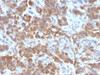 IHC testing of FFPE human parathyroid mass with TL1A antibody (clone VEGI/1283) . Required HIER: boil sections in 10mM Tris with 1mM EDTA, pH9, for 10-20 min followed by cooling at RT for 20 min.