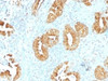 IHC testing of FFPE human rectum tissue with Villin antibody (clone VIL1/1314) . Required HIER: boil tissue sections in 10mM citrate buffer, pH 6, for 10-20 min followed by cooling at RT for 20 min.
