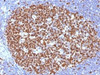 IHC testing of FFPE human tonsil with MCM7 antibody (clone MCM7/1466) . Required HIER: boil tissue sections in 10mM citrate buffer, pH 6, for 10-20 min.