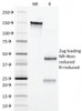 SDS-PAGE Analysis of Purified, BSA-Free Erythropoietin Antibody (clone EPO/1367) . Confirmation of Integrity and Purity of the Antibody.