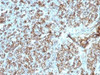 IHC testing of FFPE human tonsil tissue with HLA-DP/DQ/DR antibody (clone CR3/43) . Required HIER: boil tissue sections in 10mM citrate buffer, pH 6, for 10-20 min.