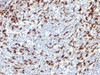 IHC testing of FFPE human tonsil with PD1 antibody. Required HIER: steam sections in 10mM Tris with 1mM EDTA, pH 9.0, for 10-20 min.