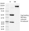 SDS-PAGE Analysis of Purified, BSA-Free N-Cadherin Antibody (clone 13A9) . Confirmation of Integrity and Purity of the Antibody.