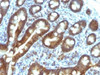 IHC testing of FFPE human duodenal carcinoma with TDP2 antibody (clone TDP2/1258) . Required HIER: boil tissue sections in 10mM Tris with 1mM EDTA, pH 9, for 10-20 min followed by cooling at RT for 20 min.
