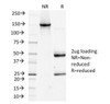 SDS-PAGE Analysis of Purified, BSA-Free Podoplanin Antibody (clone PDPN/1433) . Confirmation of Integrity and Purity of the Antibody.