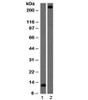 Western blot testing of 1) partial recombinant protein and 2) human lung lysate with vWF antibody (clone VWF/1465) . Predicted molecular weight ~250 kDa.