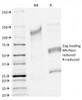 SDS-PAGE Analysis of Purified, BSA-Free CFTR Antibody (clone CFTR/1341) . Confirmation of Integrity and Purity of the Antibody.